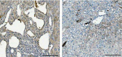 CD163 antibody