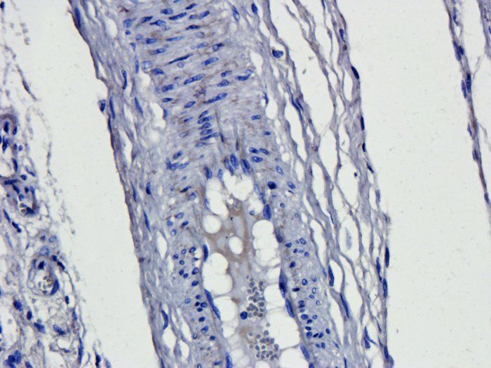 CD163 antibody