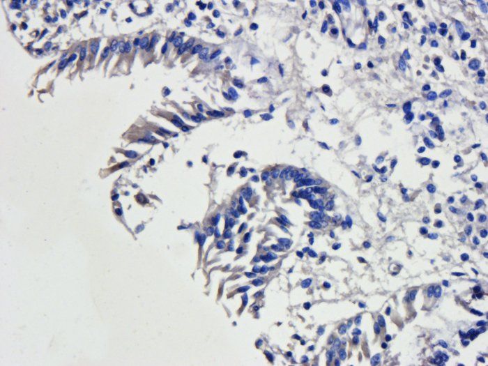 CD163 antibody