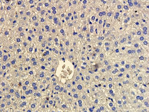 CD163 antibody