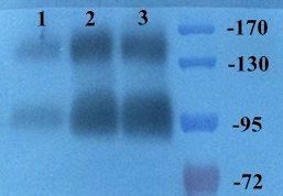 CD163 antibody