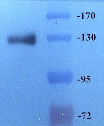 CD163 antibody