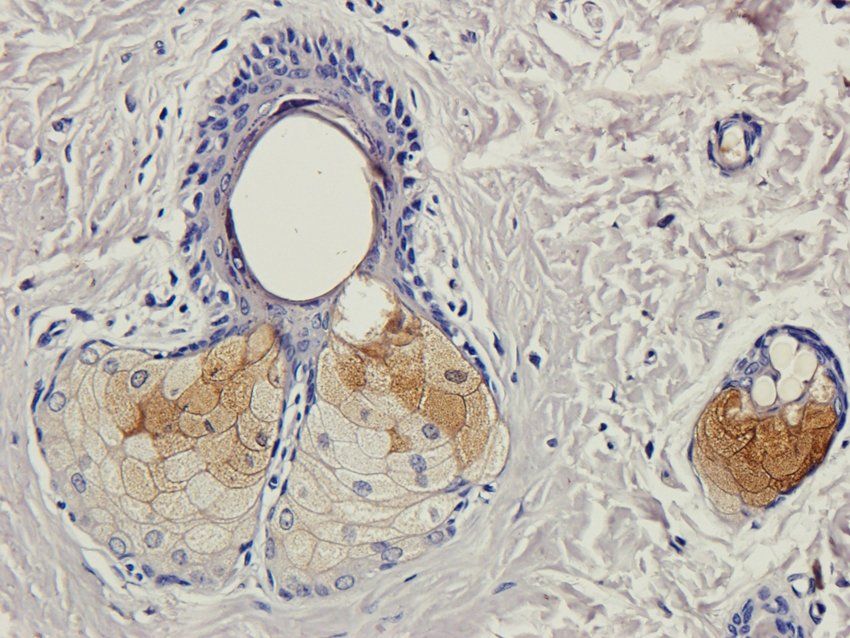 CD166 antibody