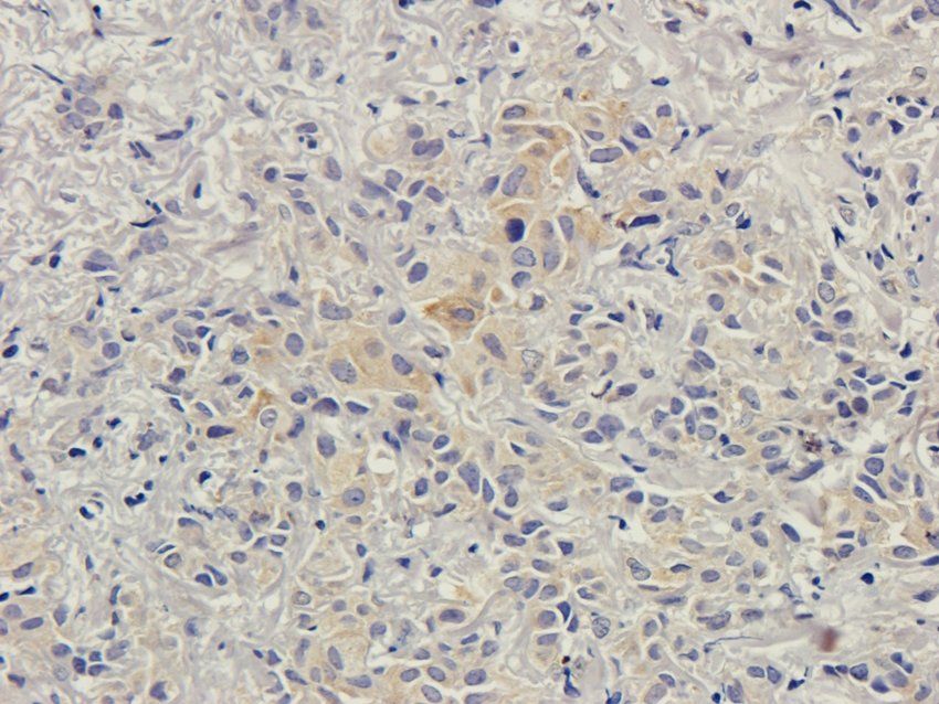 CD168 antibody