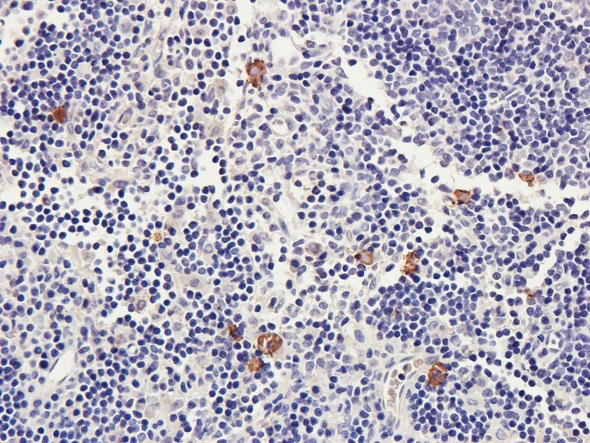 CD170 antibody