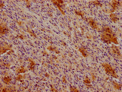 CD19 Monoclonal Antibody