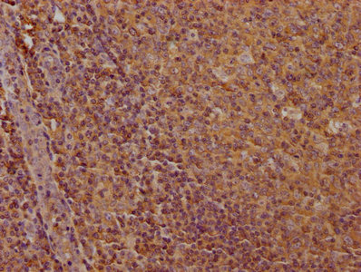 CD19 Monoclonal Antibody