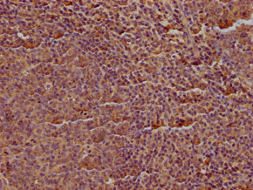 CD19 antibody