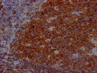 CD19 antibody