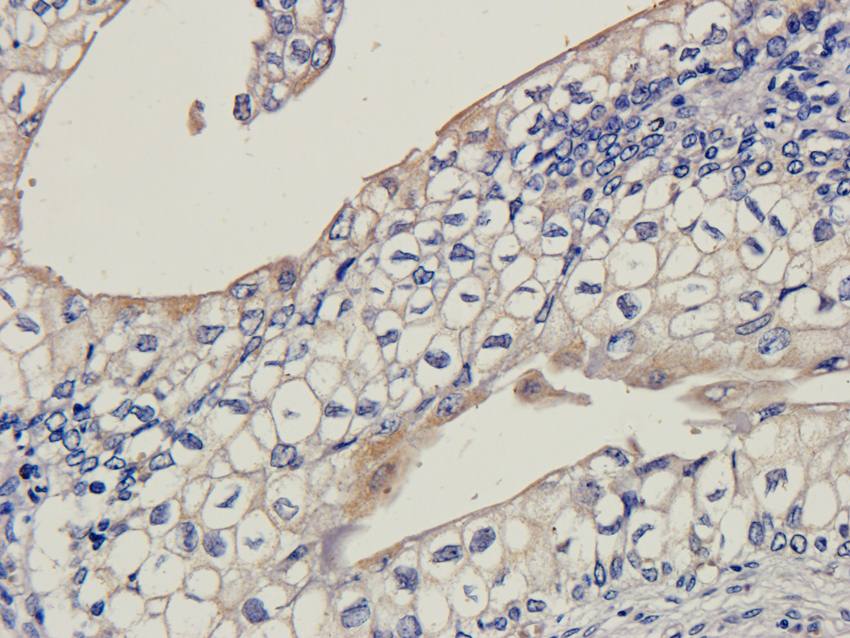 LHCGR antibody