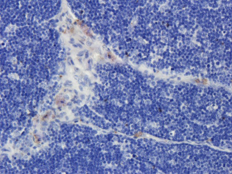 CD19 antibody