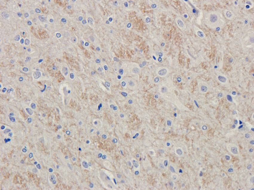 LHCGR antibody