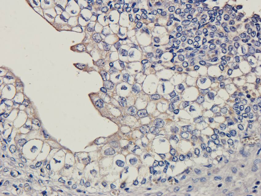 LHCGR antibody