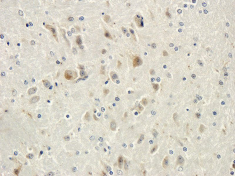 CD19 antibody