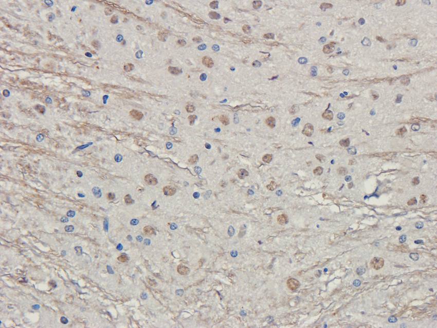 LHCGR antibody