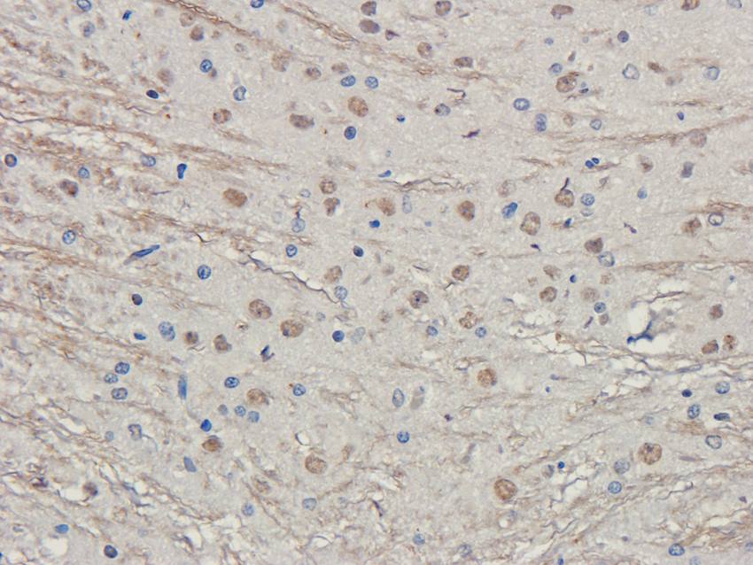 LHCGR antibody