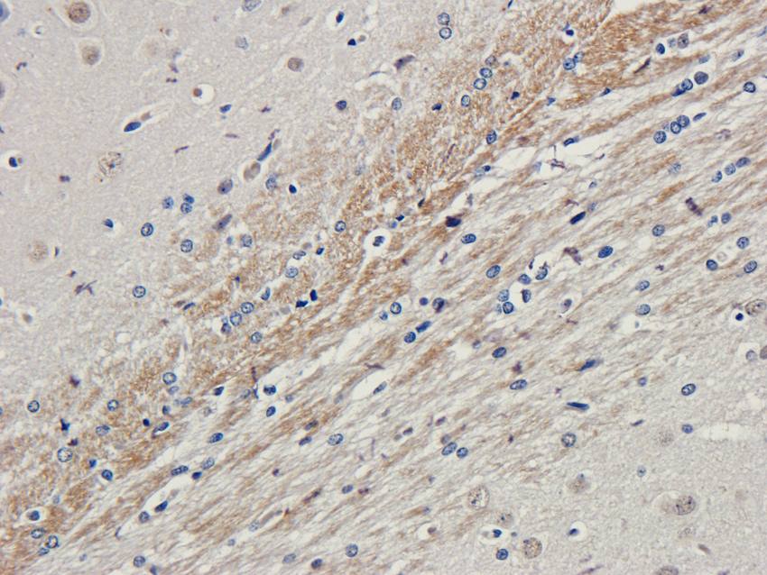 LHCGR antibody