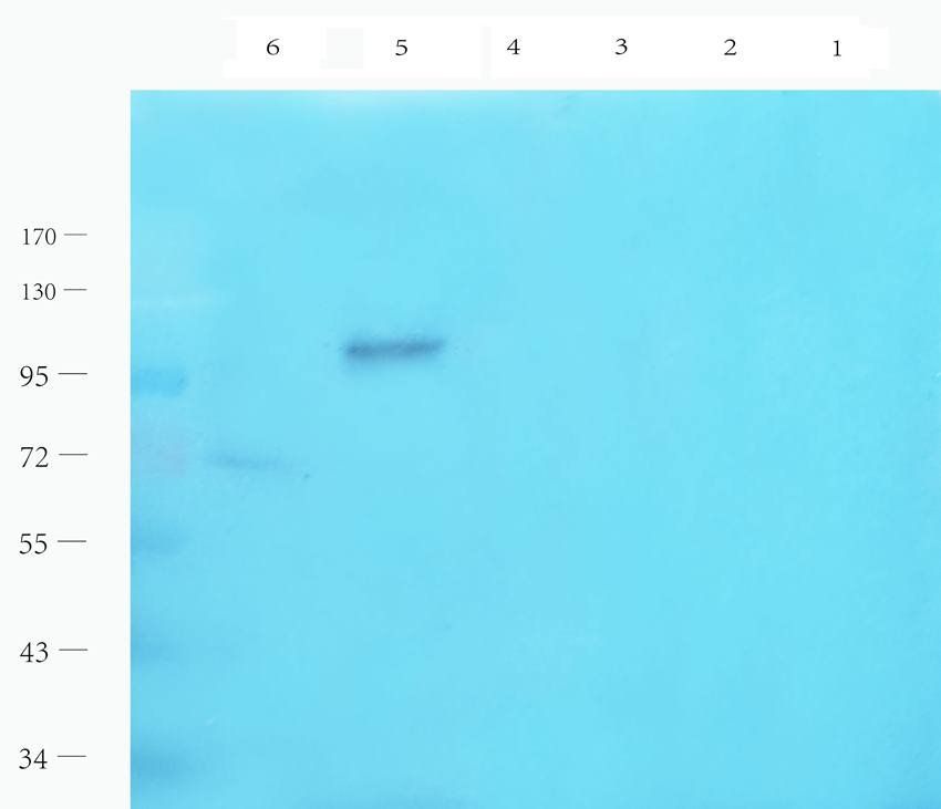 LHCGR antibody