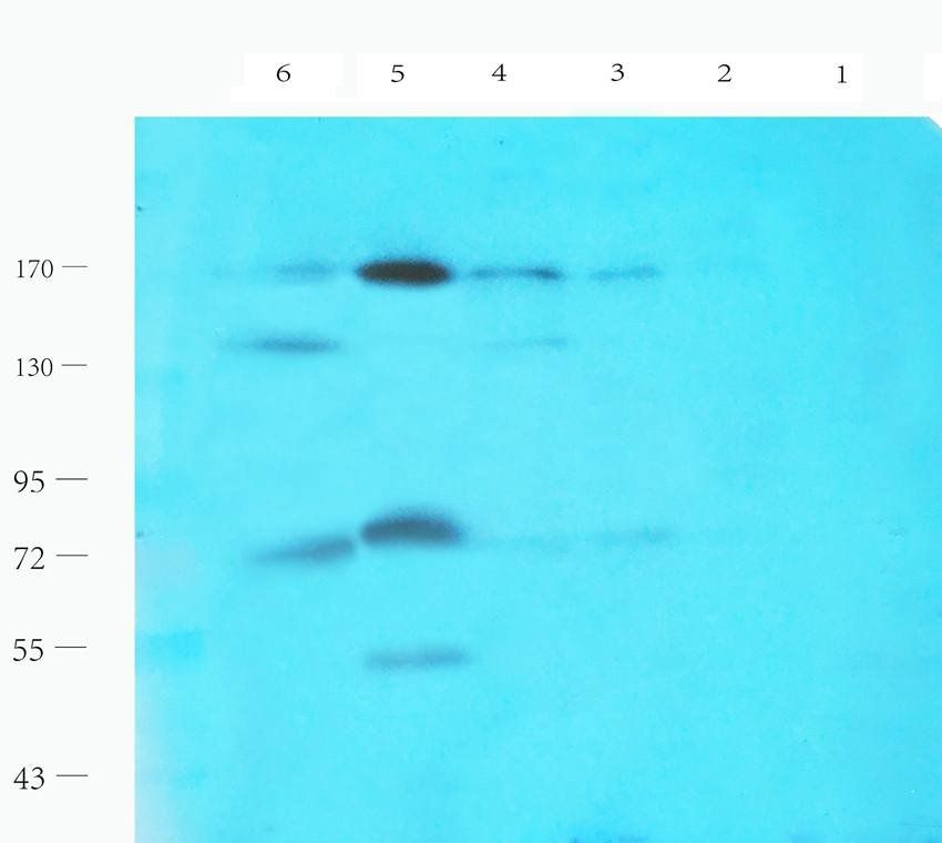 LHCGR antibody