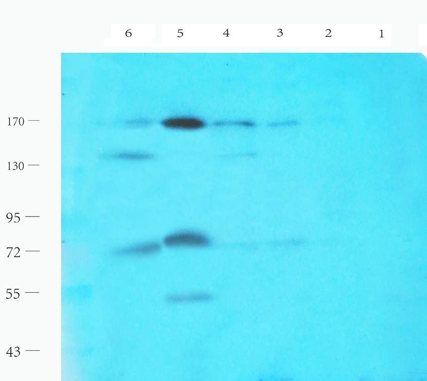 LHCGR antibody