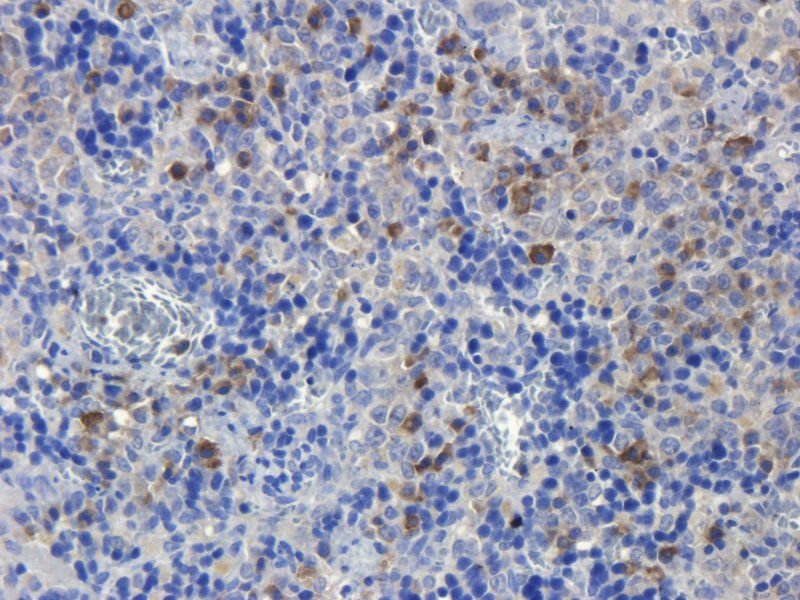 CD19 antibody