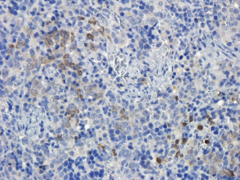 CD19 antibody