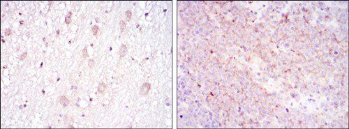 CD1A Antibody