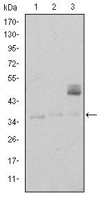 CD1A Antibody