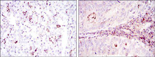 CD1A Antibody