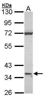CTD small phosphatase 2 Antibody
