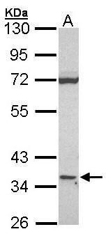 CTDSP2 antibody