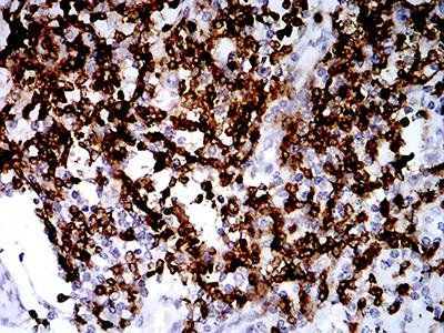 CD2 Antibody