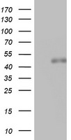 CD20 Antibody