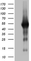 CD20 Antibody