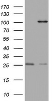 CD20 Antibody