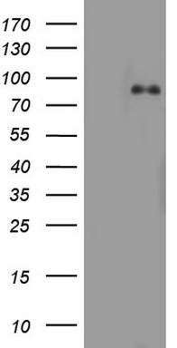 CD20 Antibody