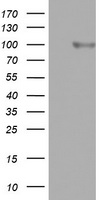 CD20 Antibody