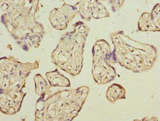 CD200 Antibody