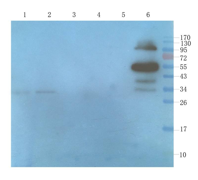 CD200 antibody