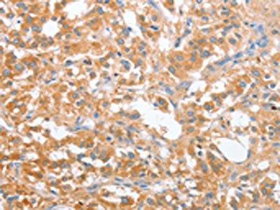CD200R1 Antibody