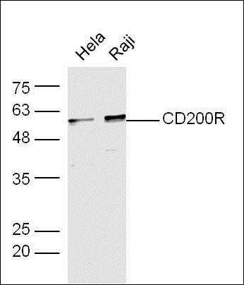 Cd200R antibody