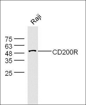 Cd200R antibody