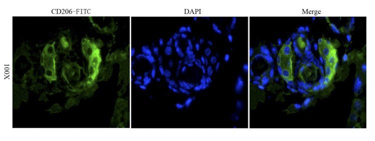 CD206 antibody (FITC)