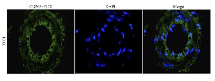 CD206 antibody (FITC)