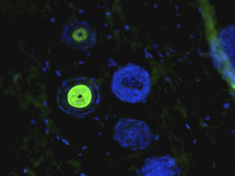 CD206 antibody (FITC)