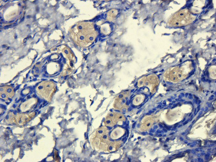 CD206 antibody