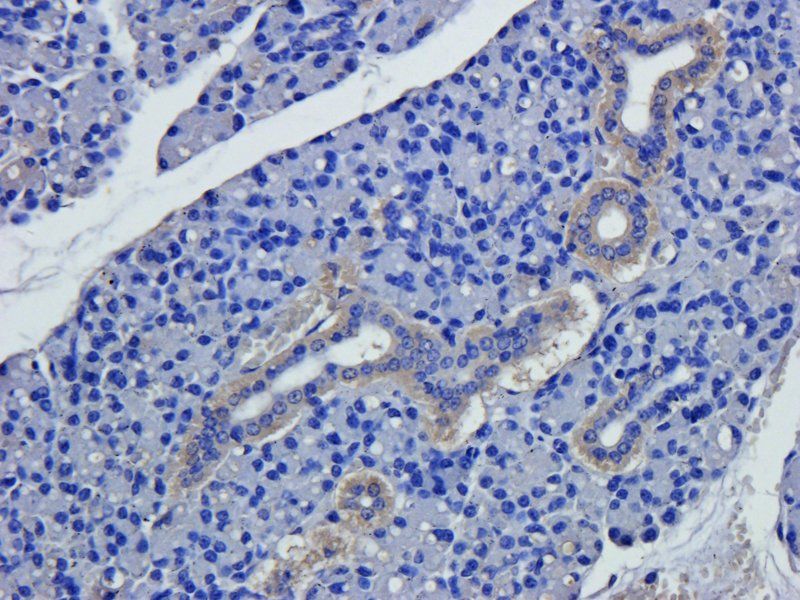 CD206 antibody