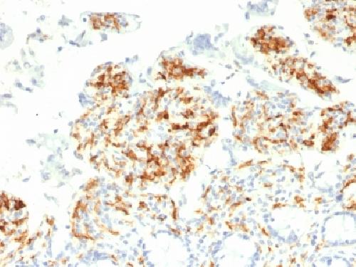 CD209 / DC-SIGN (Pathogen Receptor on Dendritic Cells) Antibody