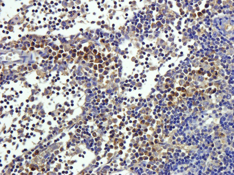 CD20 antibody