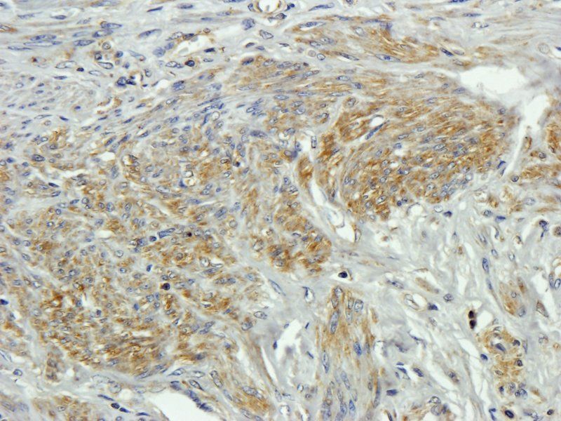 CD20 antibody